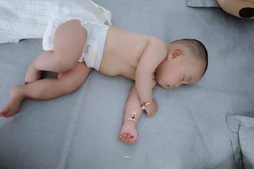 张掖宝宝脸上有白色斑块